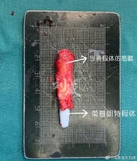 筋膜球防滑涂层制作误区详解！施工工艺与注意事项